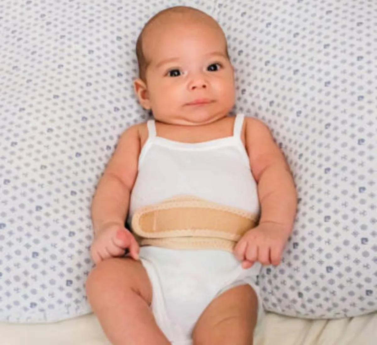 صورة لتصرف خاطيء لعلاج الفتق السري