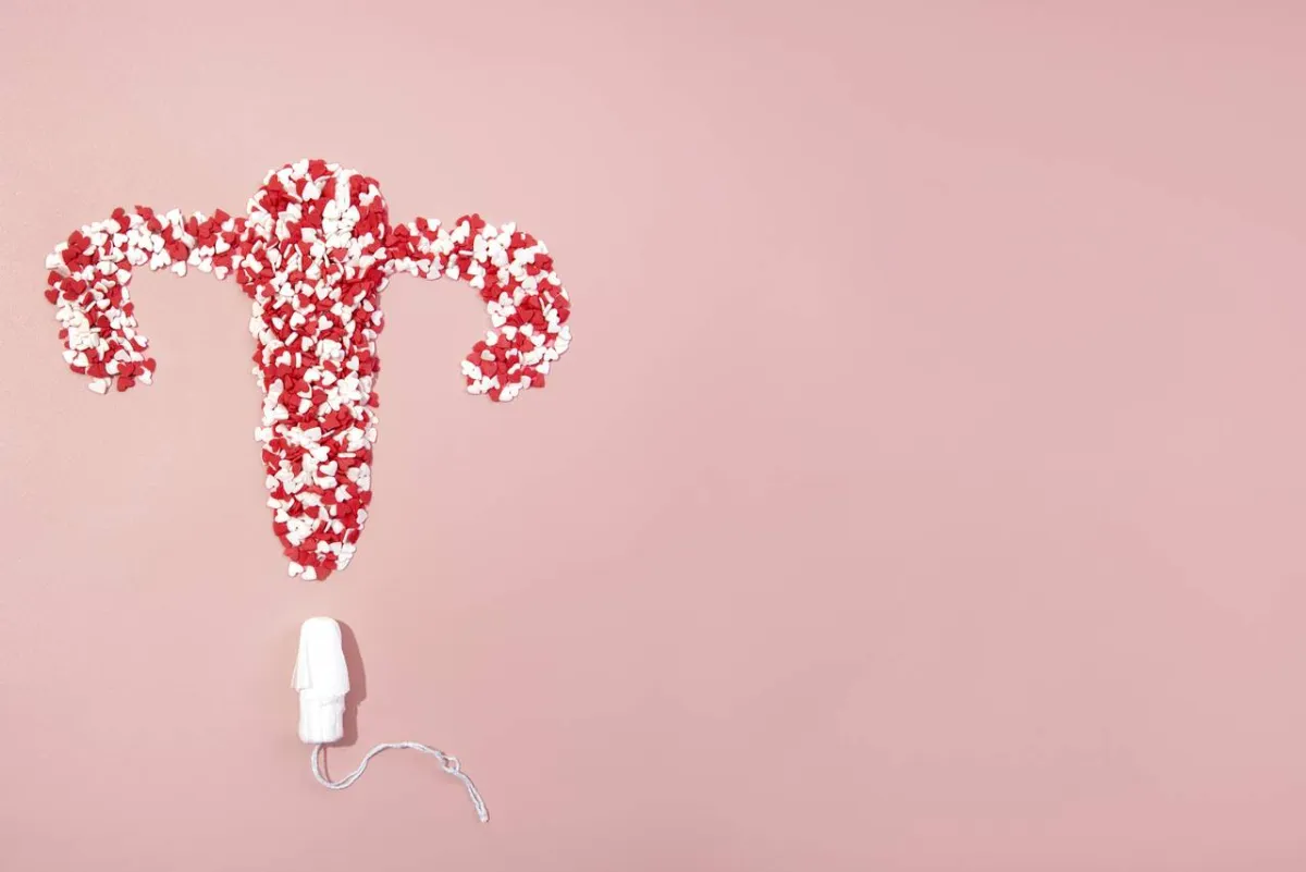 صورة لتكيس المبايض