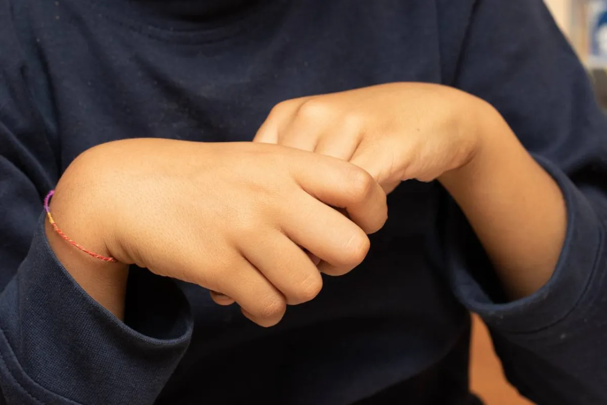 صورة لطفل عض يده