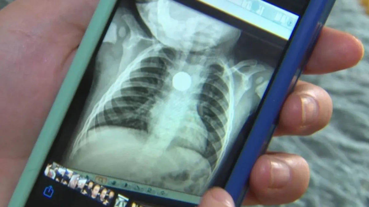  تحذير حملة في بريطانيا من خطر البطاريات على الأطفال