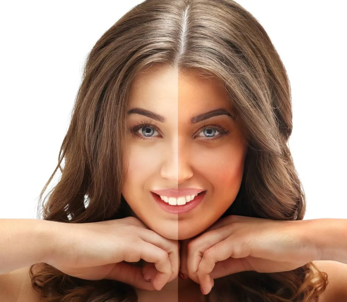 بقع التسمير الذاتي