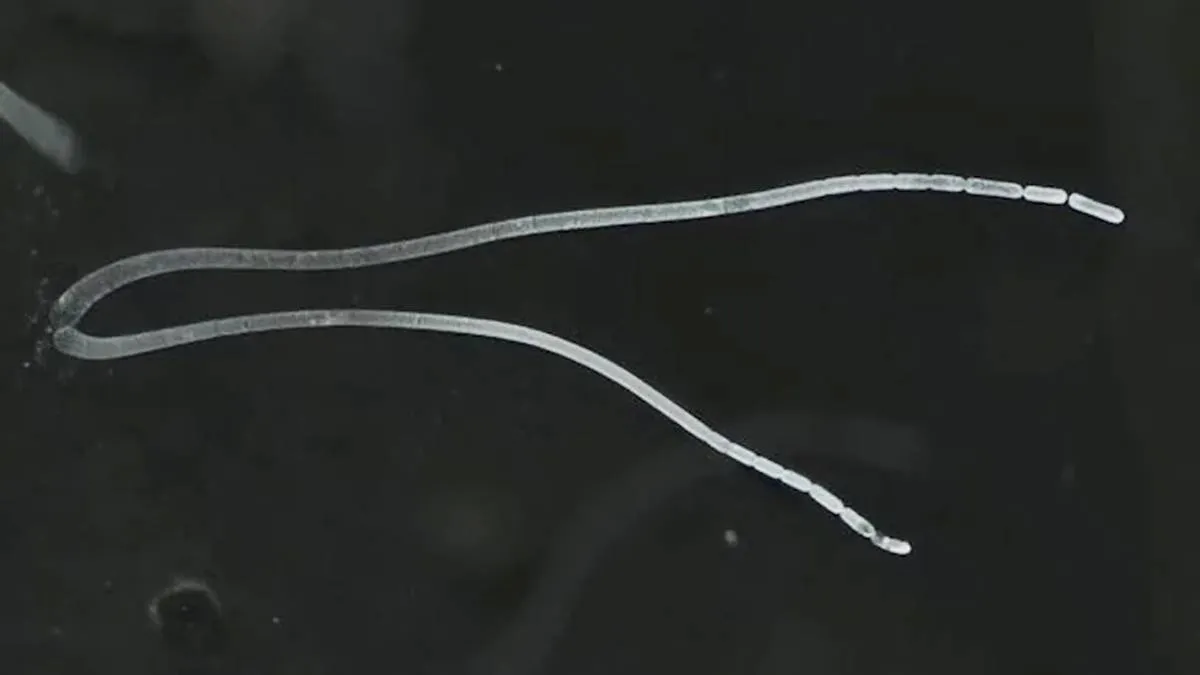 اكتشاف مذهل لأكبر بكتيريا في العالم تُرى بالعين المجردة