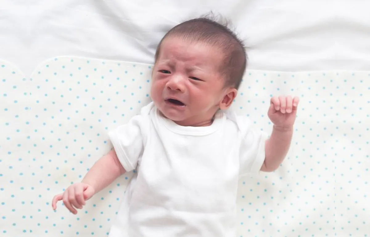 مرض الإسكندر عند الرضع