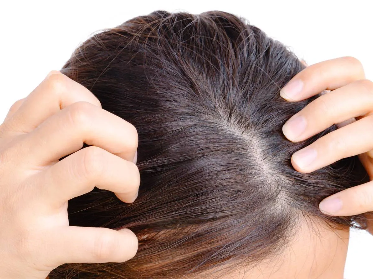 طرق تغطية فراغات الشعر