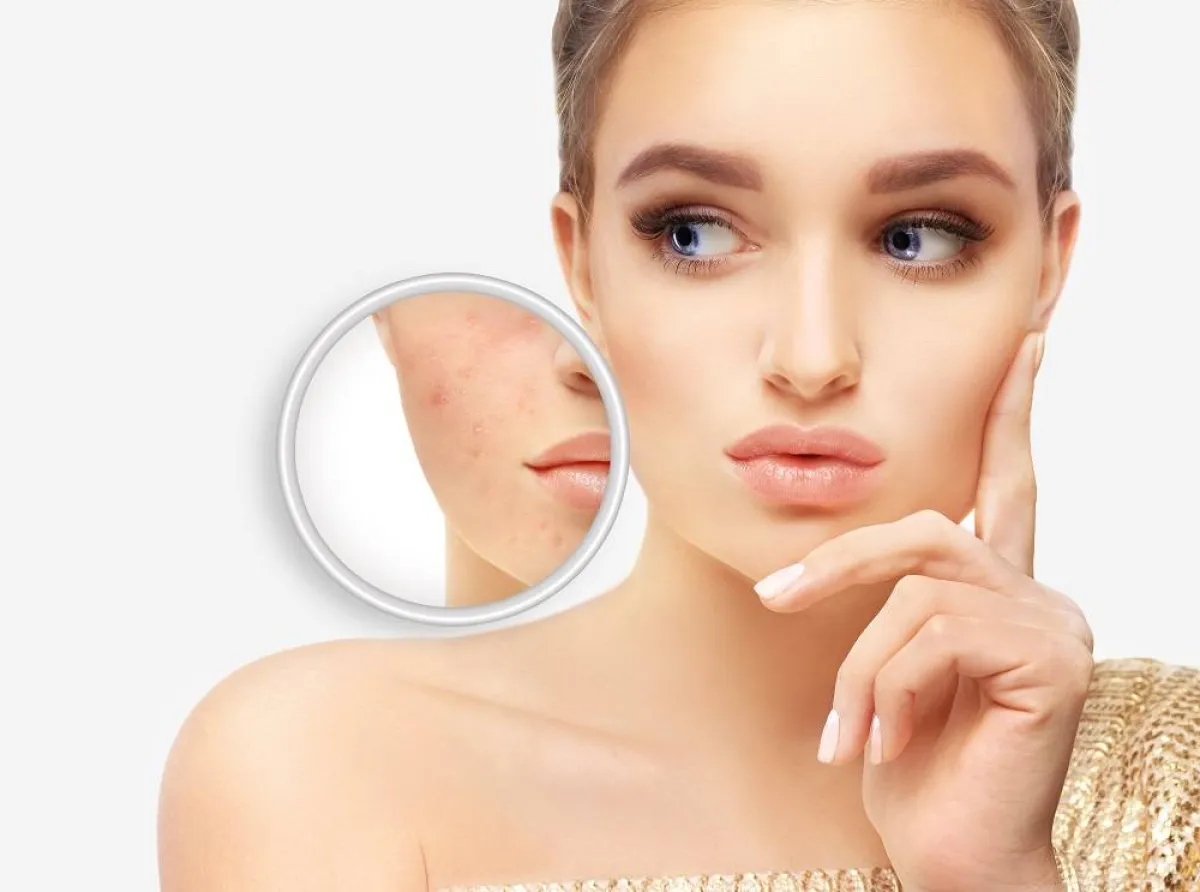 تنقية البشرة