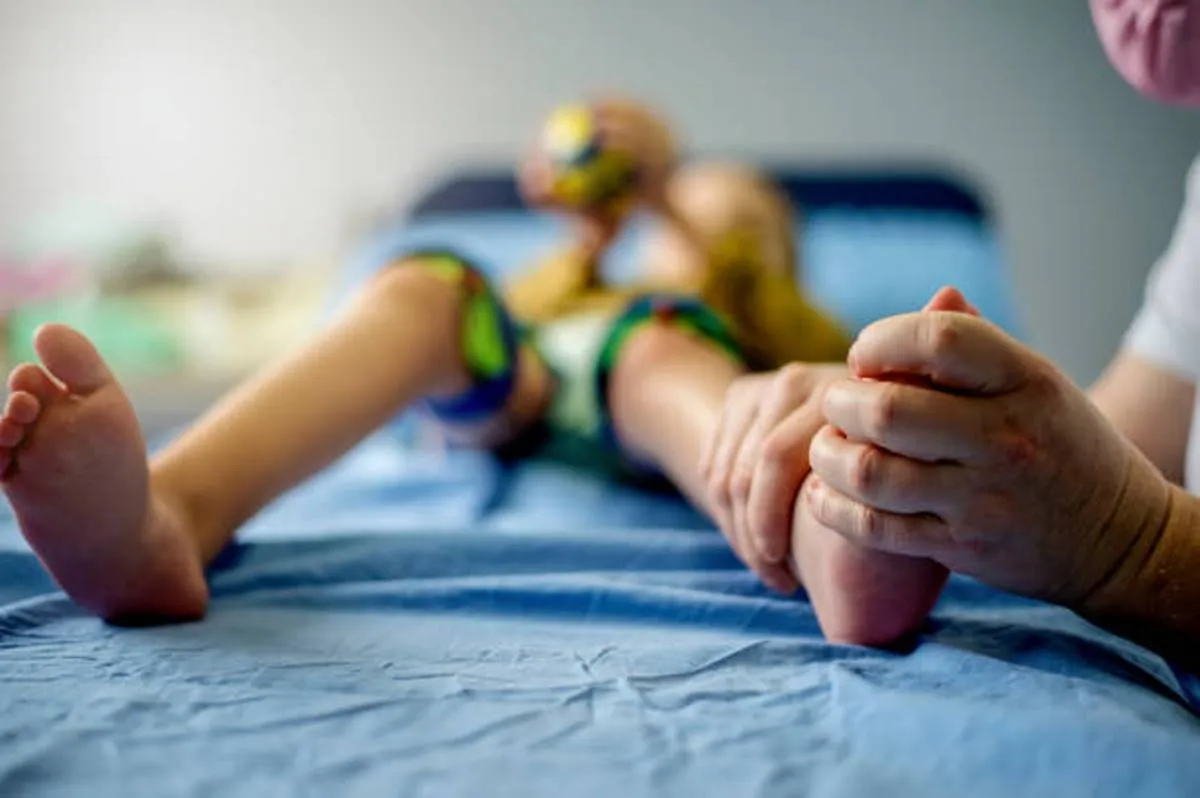 صورة لطفل يعاني من ضعف في عضلات ساقيه