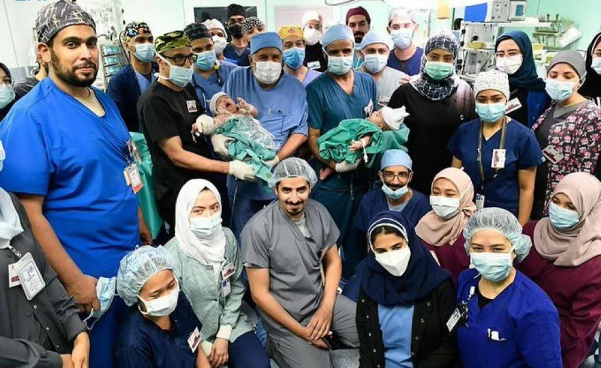 نجاح فصل التوأم السيامي اليمني مودة ورحمة وتحقيق إنجازات جديدة 