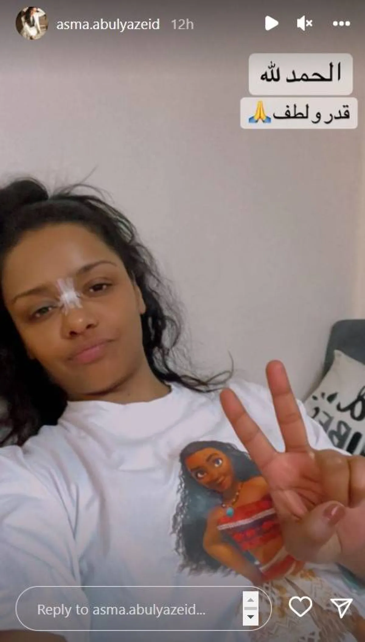 أسماء أبو اليزيد تتعرض للإصابة في أنفها - ستوري من حسابها على انستغرام