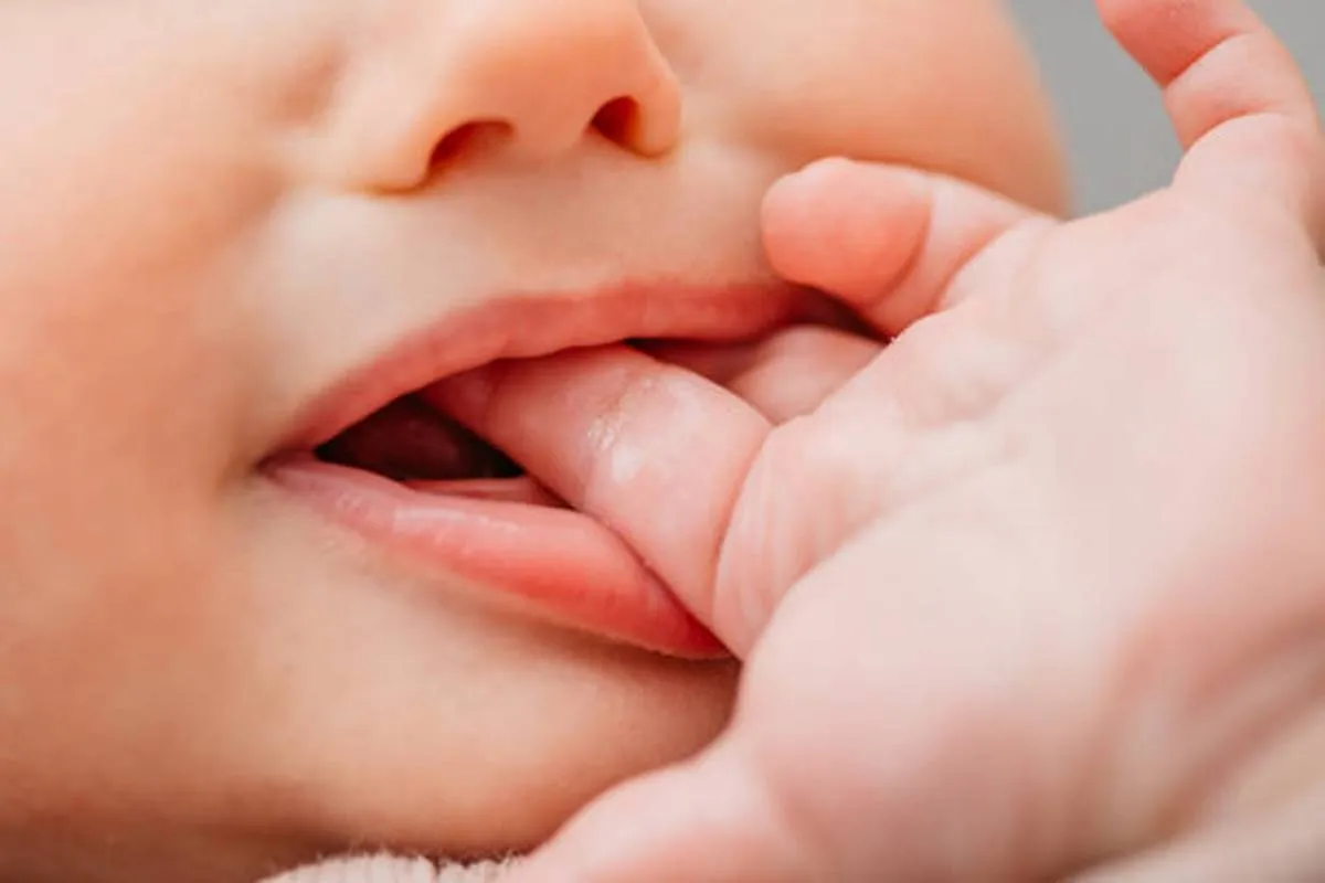 صورة لمولود لديه مشاكل في الفم