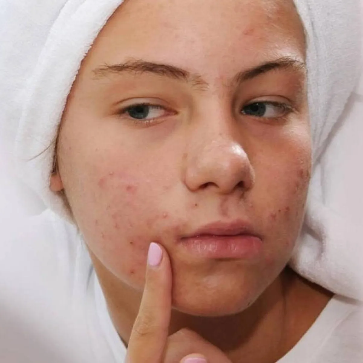 صورة لحامل وطفح جلدي