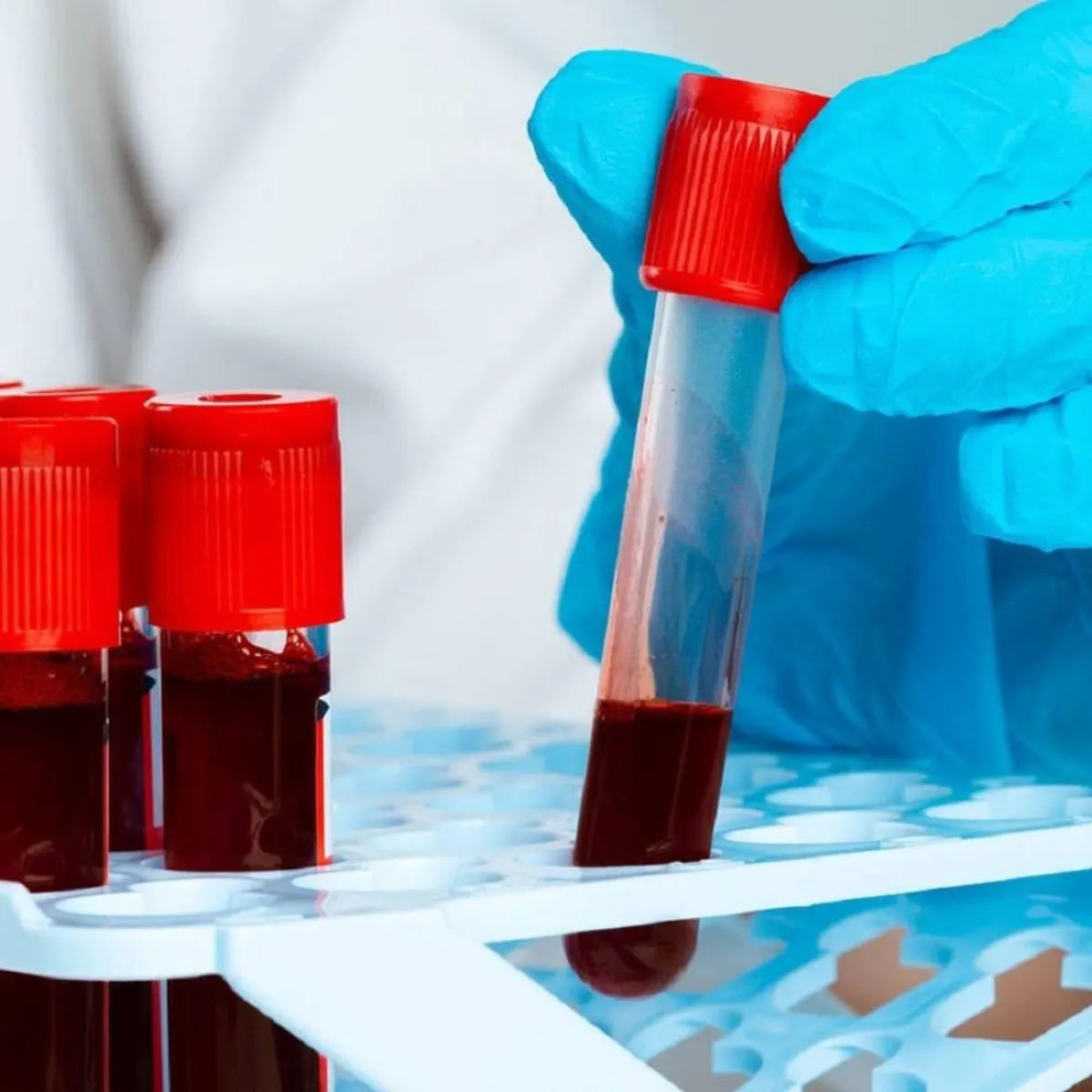 صورة لبعض الصفائح الدموية