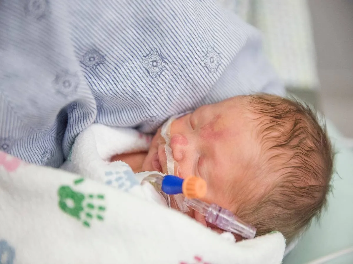 صورة لطفل مبتسر مريض