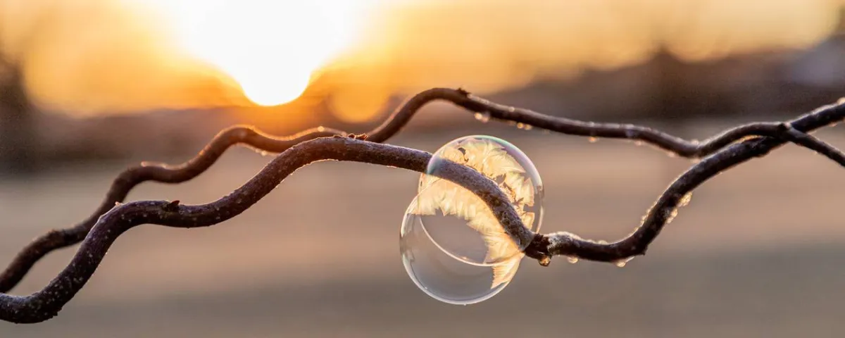 صورة تعبيرية عن المثانة