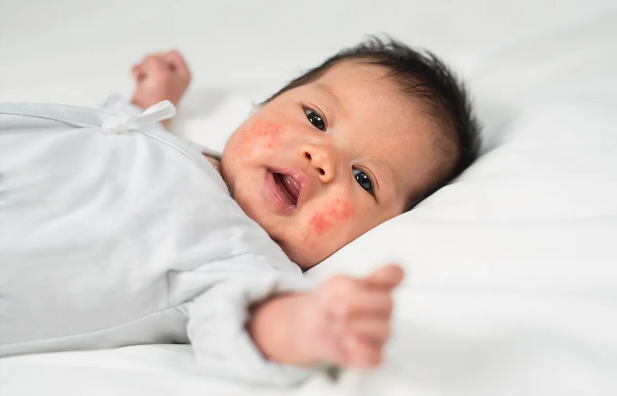 كل ما تريدين معرفته عن الحساسية داخل المنزل عند الأطفال