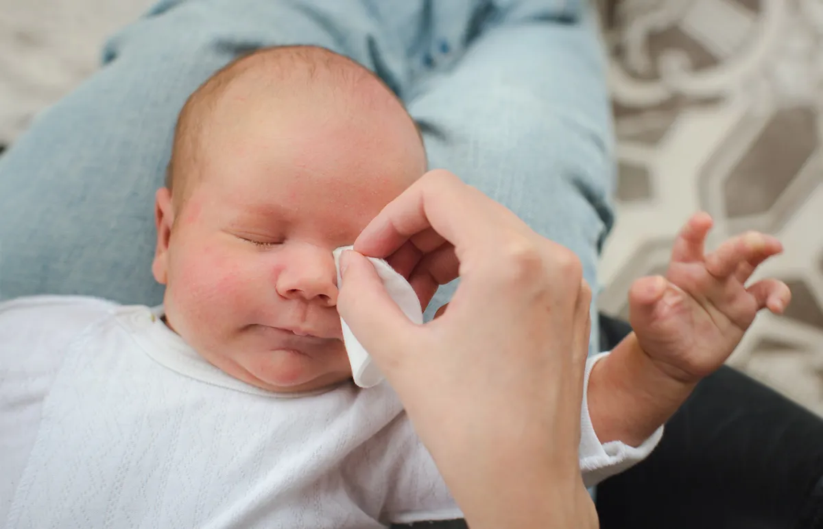 علاج انسداد القناة الدمعية للرضع