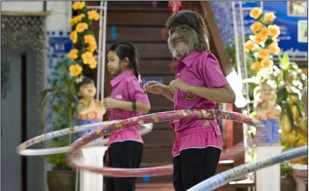 سوباترا ساسوفان- الفتاة الذئب