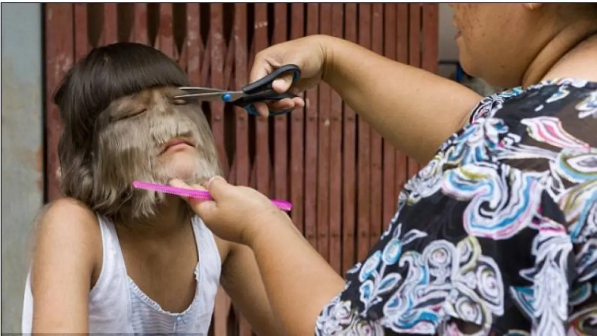 سوباترا ساسوفان- الفتاة الذئب