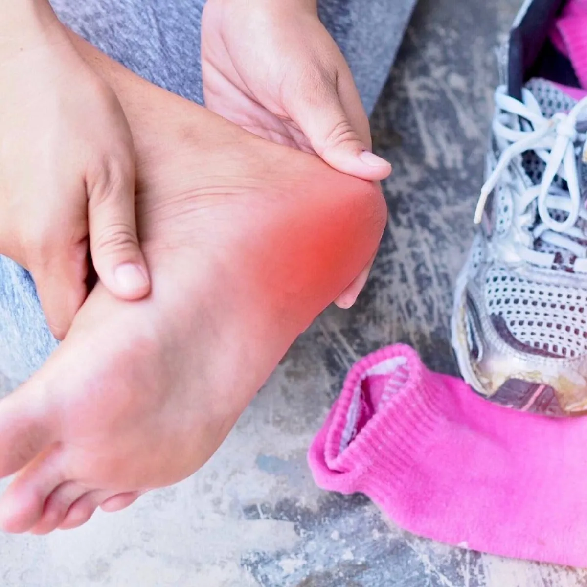 صورة لقدم ملتهبة