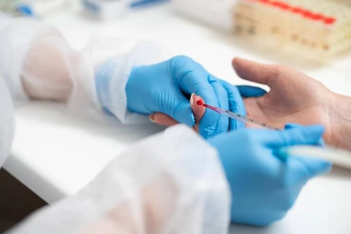 علاج جديد للأمراض عبر فصادة الدم.. طبيبة إماراتية تتحدث