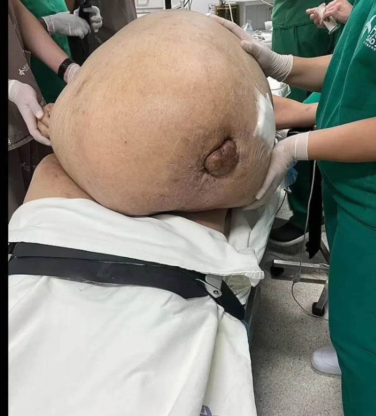 ورم وزنه 45 كلغ 