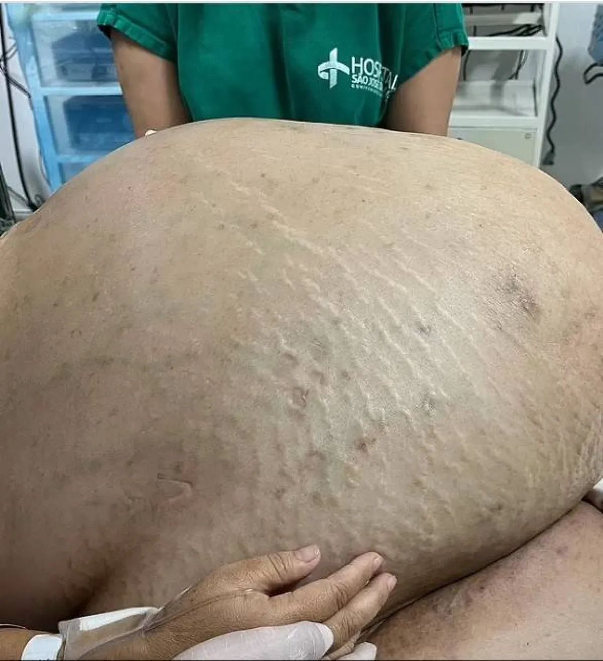 ورم وزنه 45 كلغ 