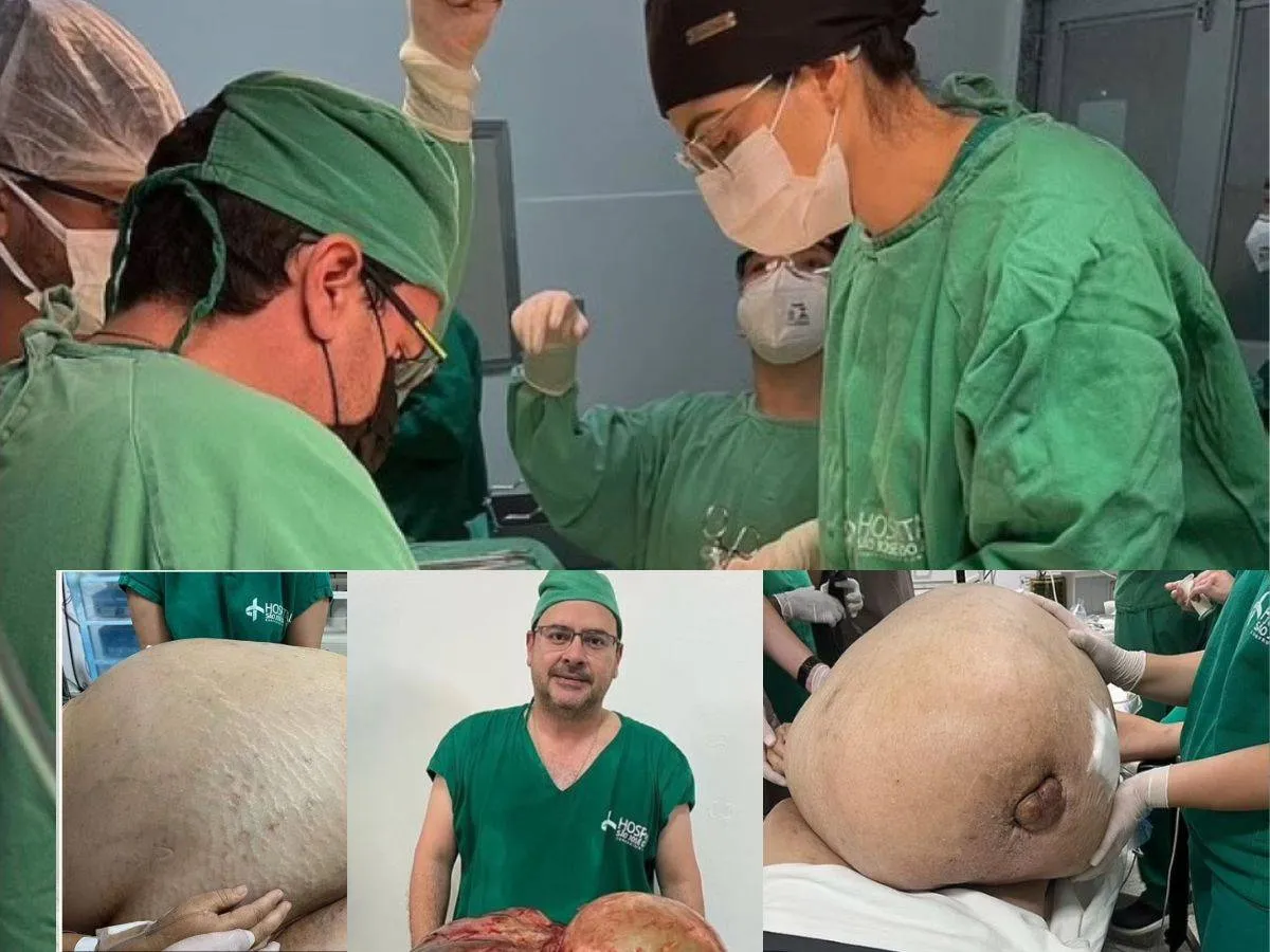  ورم وزنه 45 كلغ 