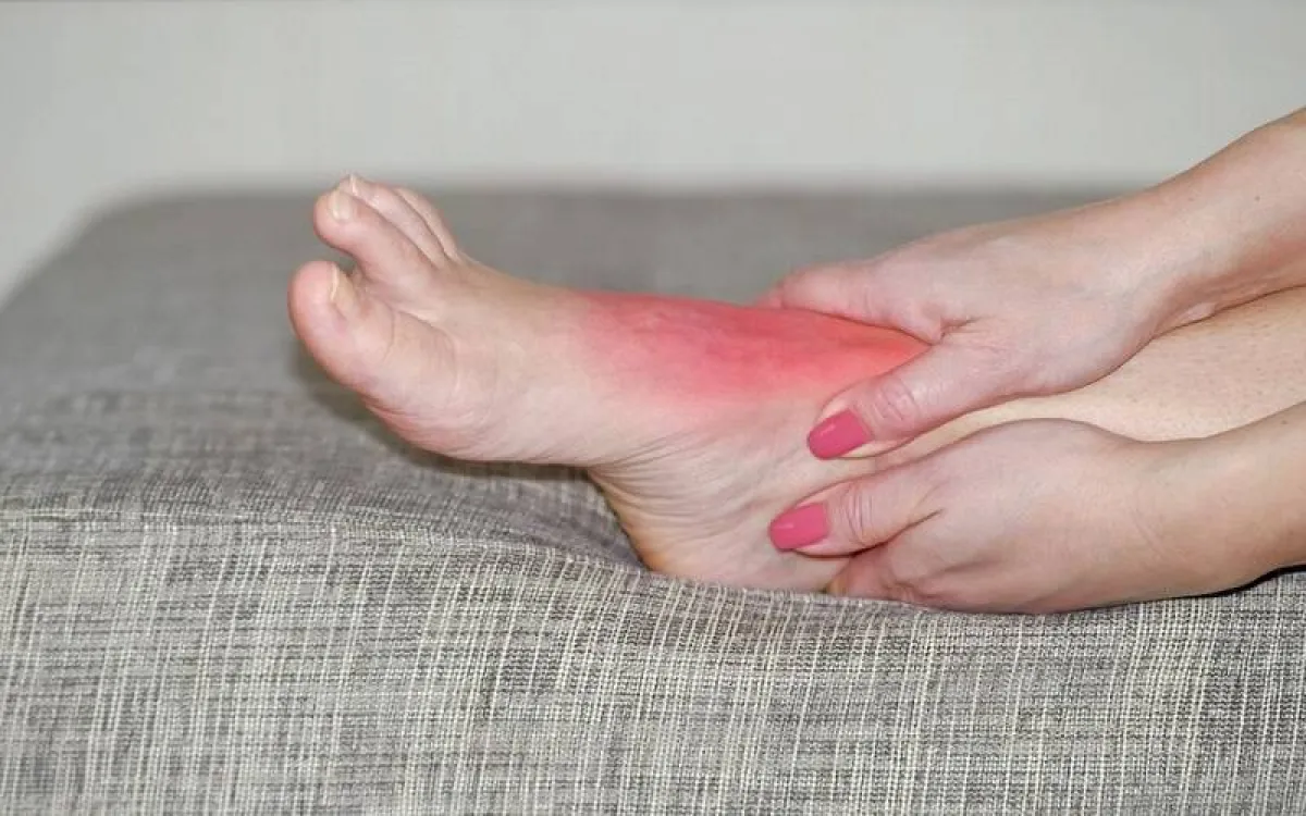 آلام في سطح وأسفل القدم