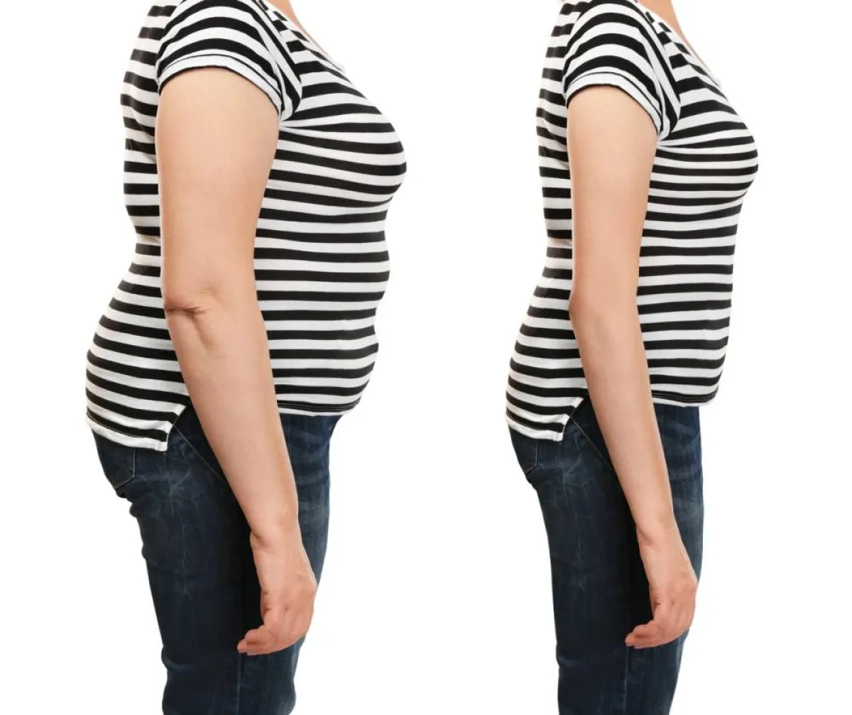 صورة لترهل البطن