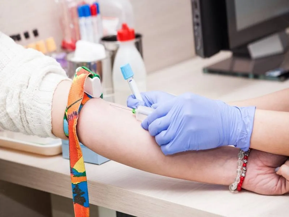 نزيف اللثة والأنف من أبرز أعراض نقص الصفائح الدموية