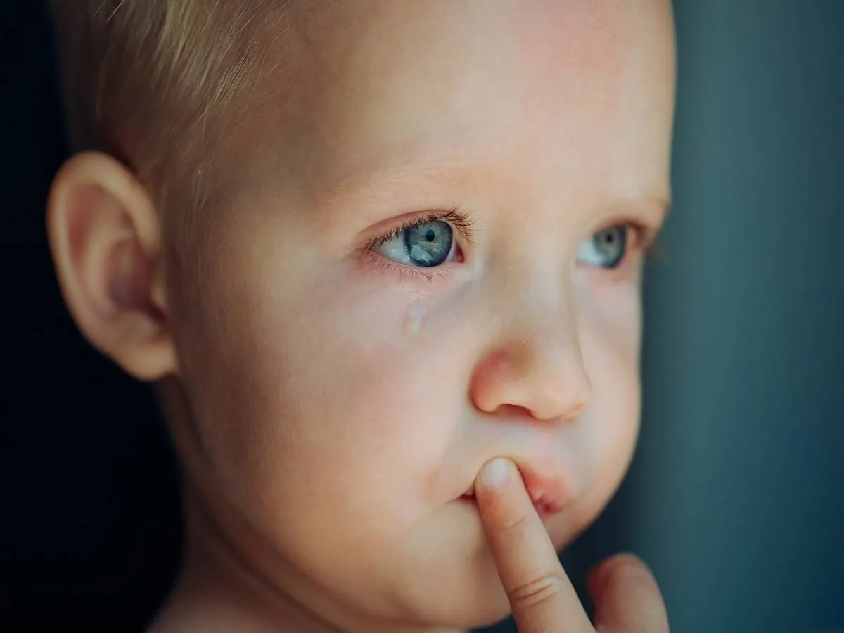 صورة لطفل مصاب بالرمد