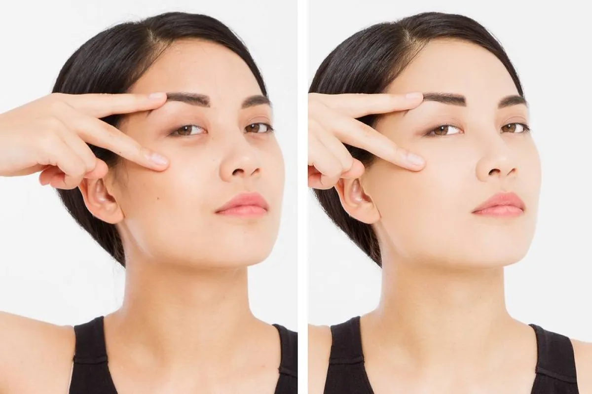 طرق التخلص من الهالات السوداء