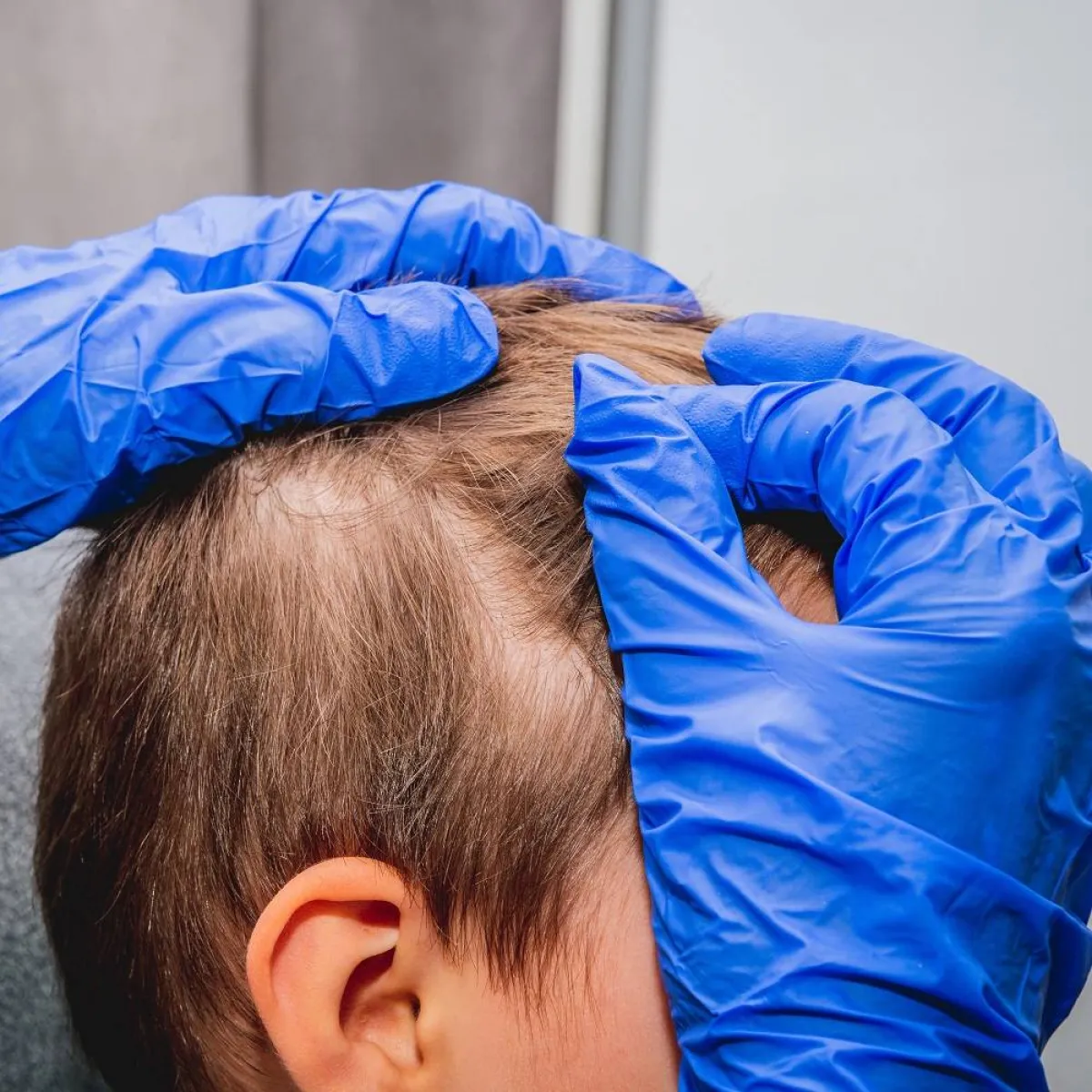 صورة لطفل وأم تفحص رأسه