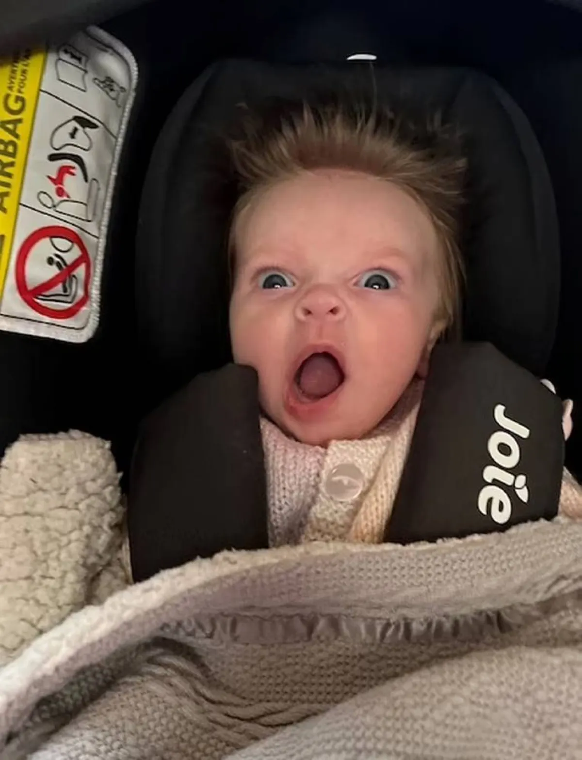 أم تتفاجأ بشعر طفلتها بعد 10 أسابيع من ولادتها