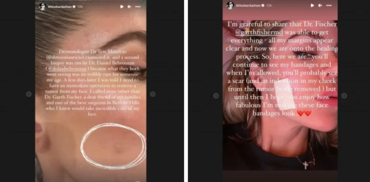 ستوري كلوي كارداشيان في إنستغرام