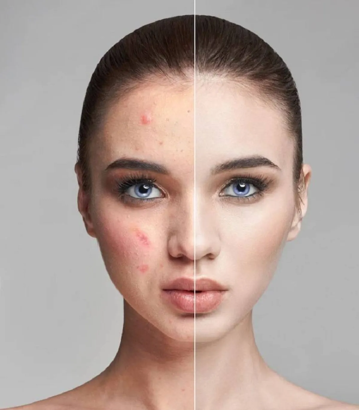 خلطات للبشرة