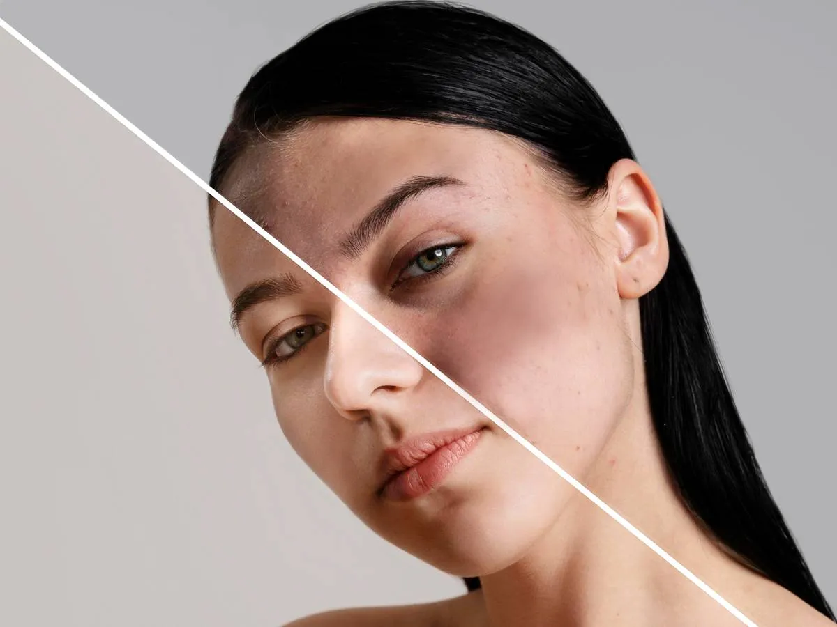 علاج البقع البنية في الوجه بالاعشاب