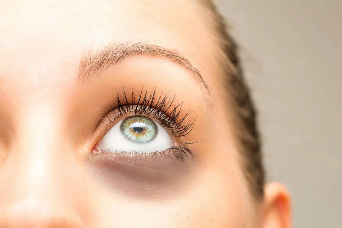 الهالات السوداء