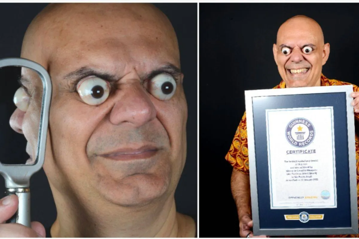 صاحب أكبر عينين في العالم