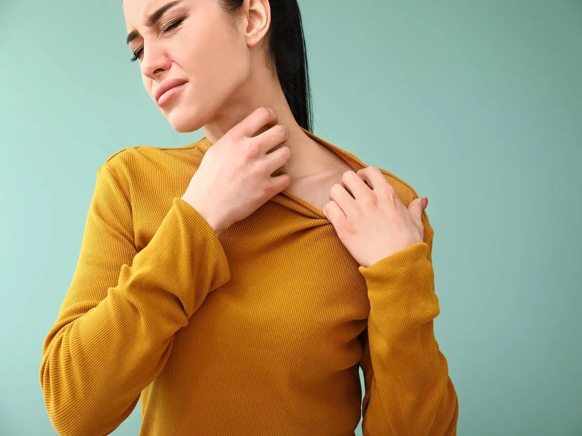 الطفح الجلدي الحراري في الشتاء «المصدر: Adope.stock»