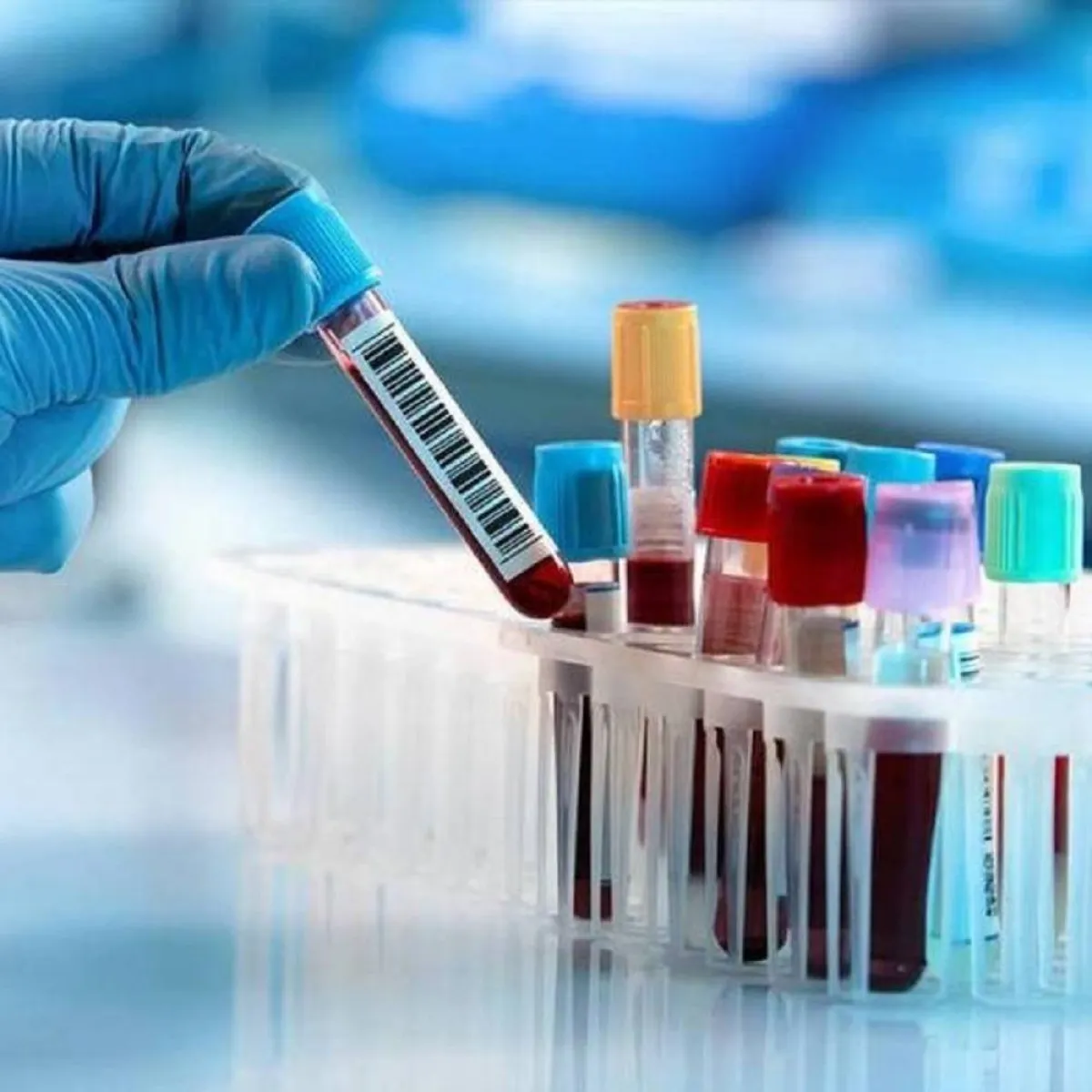 صورة للفحوص المختبرية للحمل