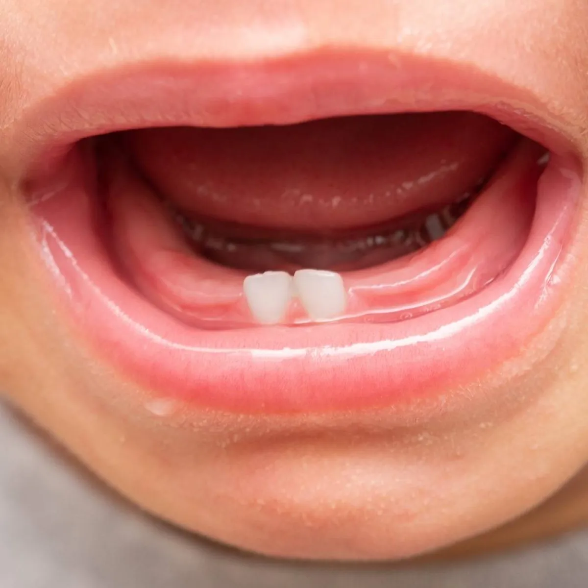 صورة لطفل يبكي ألم التسنين