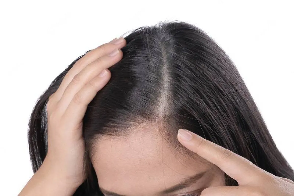 التخلص من الشعر الأبيض