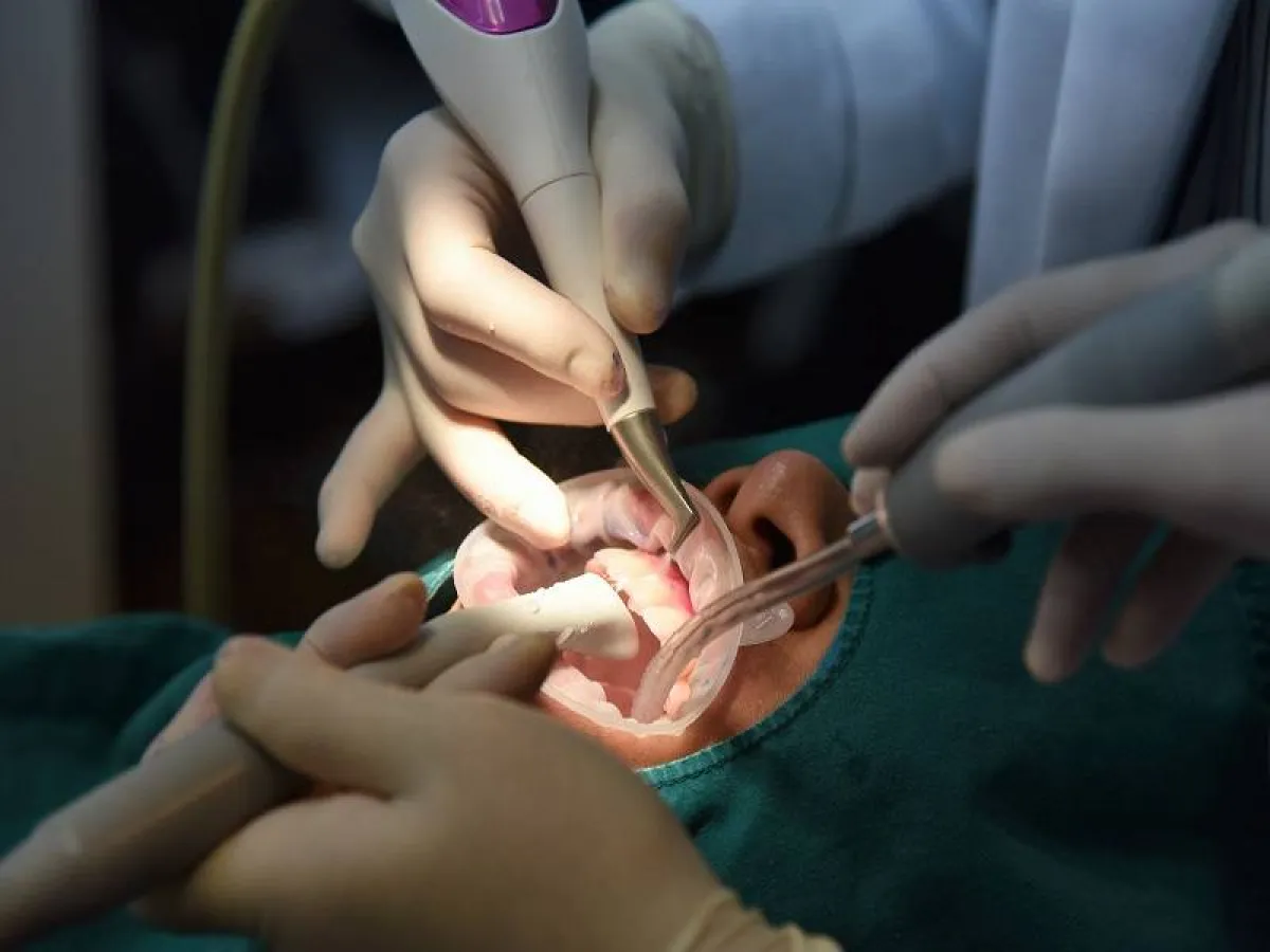 في بعض الحالات تكون الجراحة ضرورية لعلاج كسر الفك اعتمادًا على شدة الإصابة (المصدر : Adobe.stock)