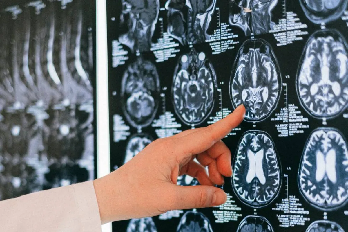 ظهور علامات شيخوخة على المراهقين.. والسبب كورونا