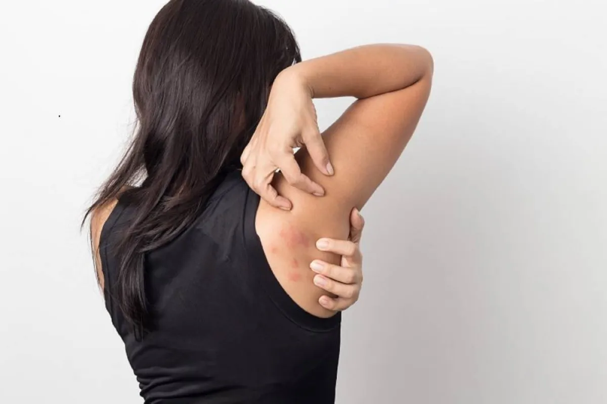 التهاب المفاصل الصدفي والصدفية من أمراض المناعة الذاتية التي تنجم عن خلل في جهاز المناعة -المصدر: Adobe.stock