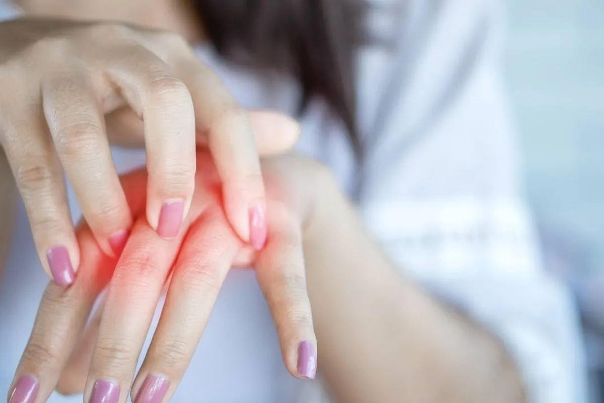 صورة لحامل تعاني من حكة اليدين