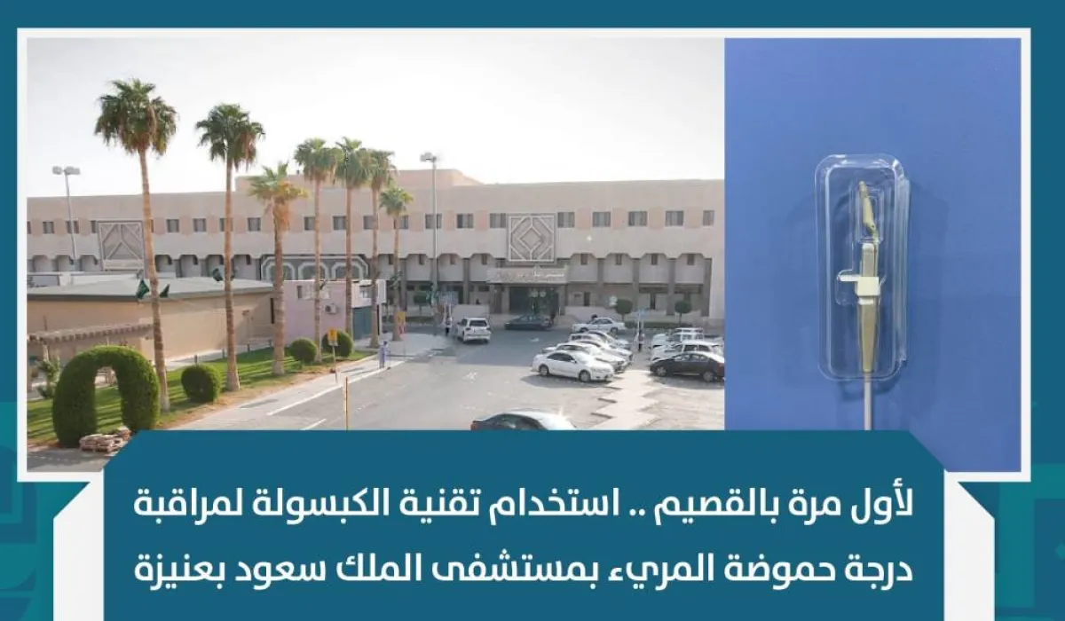 استخدام تقنية الكبسولة لمراقبة درجة حموضة المريء بمستشفى الملك سعود بعنيزة