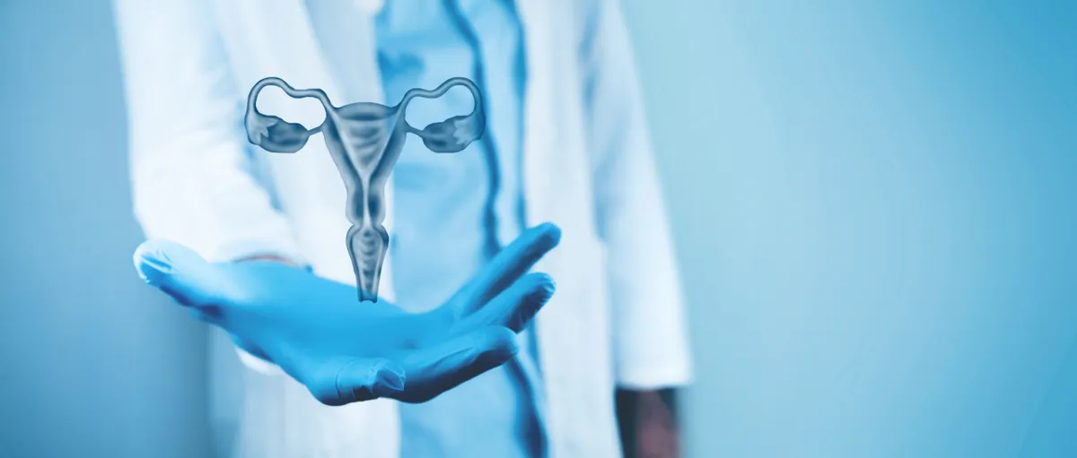 صورة تعبيرية عن متلازمة تكيس المبيض