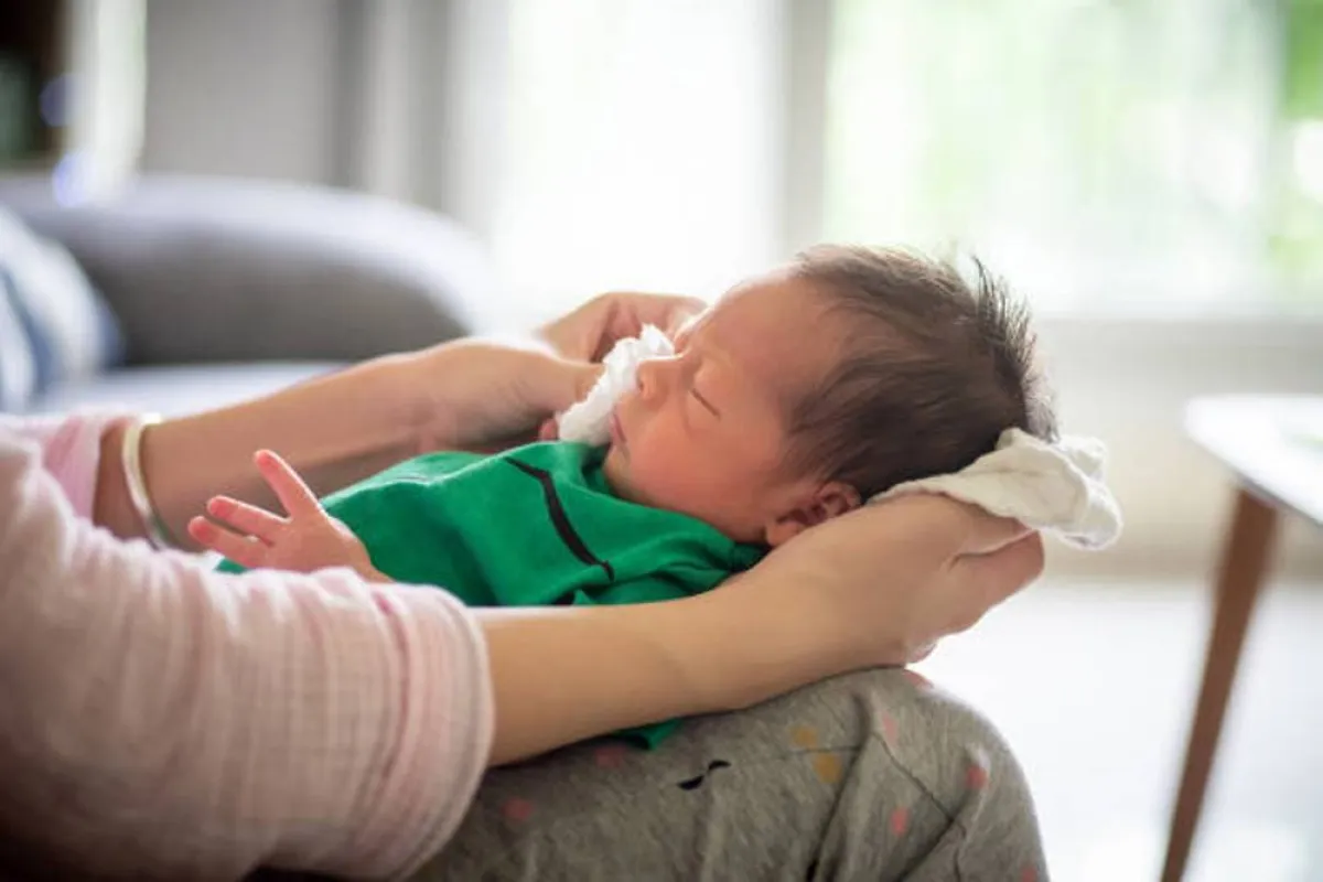 صورة لرضيع لديه فرط تعرق من الرأس بصورة مقلقة