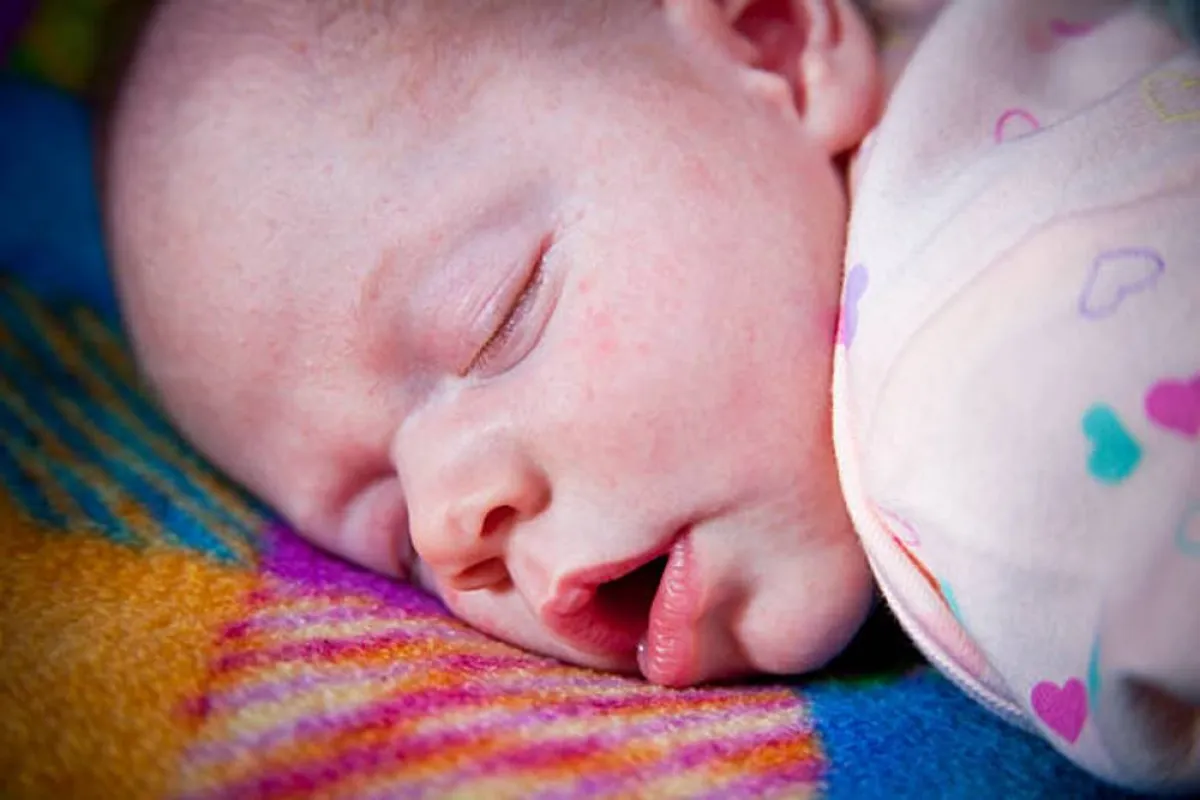 صورة لطريقة سيلان مزعجة من فم الرضيع